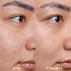 Banana Bright Vitamin C Serum