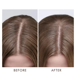 Dry Scalp Treatment