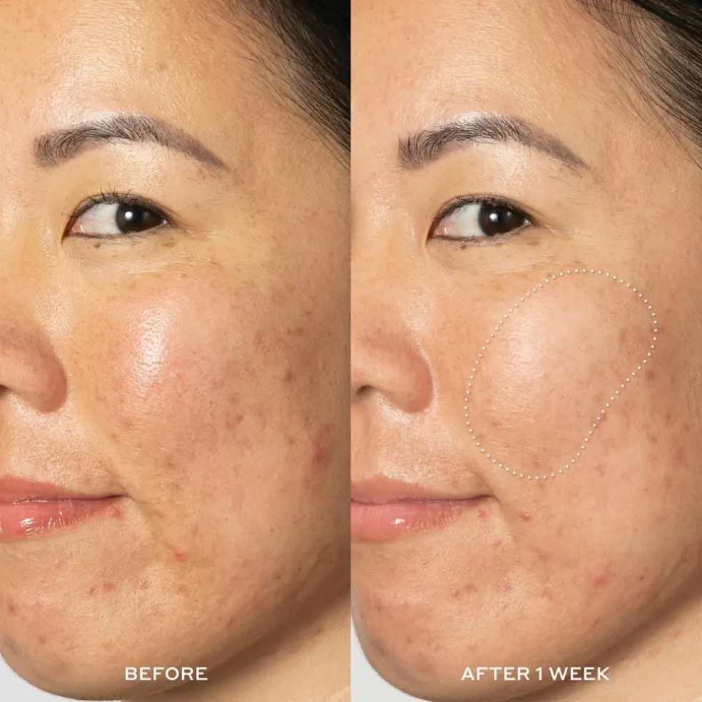Glow2OH Dark Spot Toner