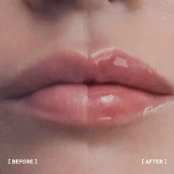Hyalu-Filler Lips