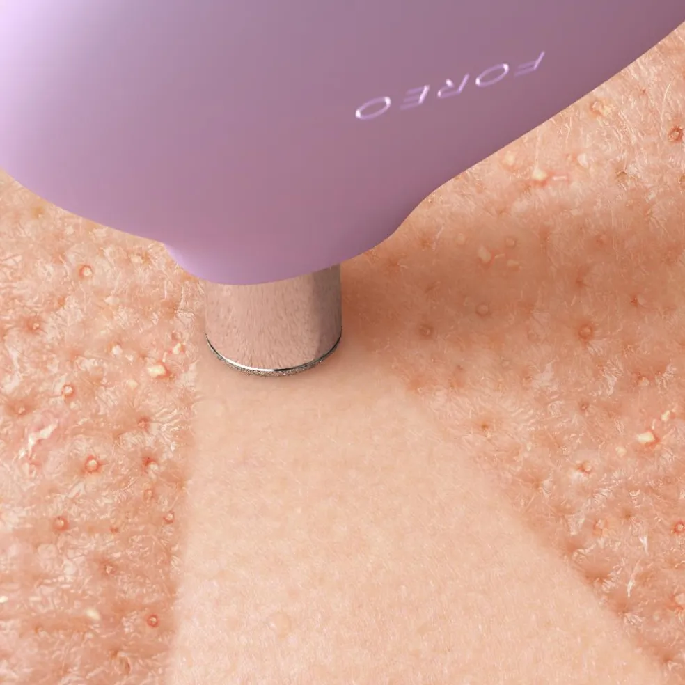 KIWI Derma