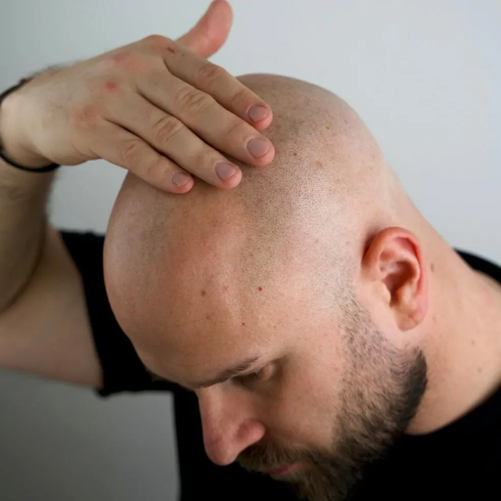 Magic Bald Head & Beard Oil