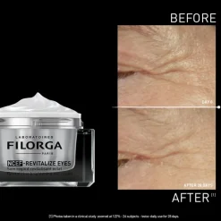 NCEF-Revitalize Eyes