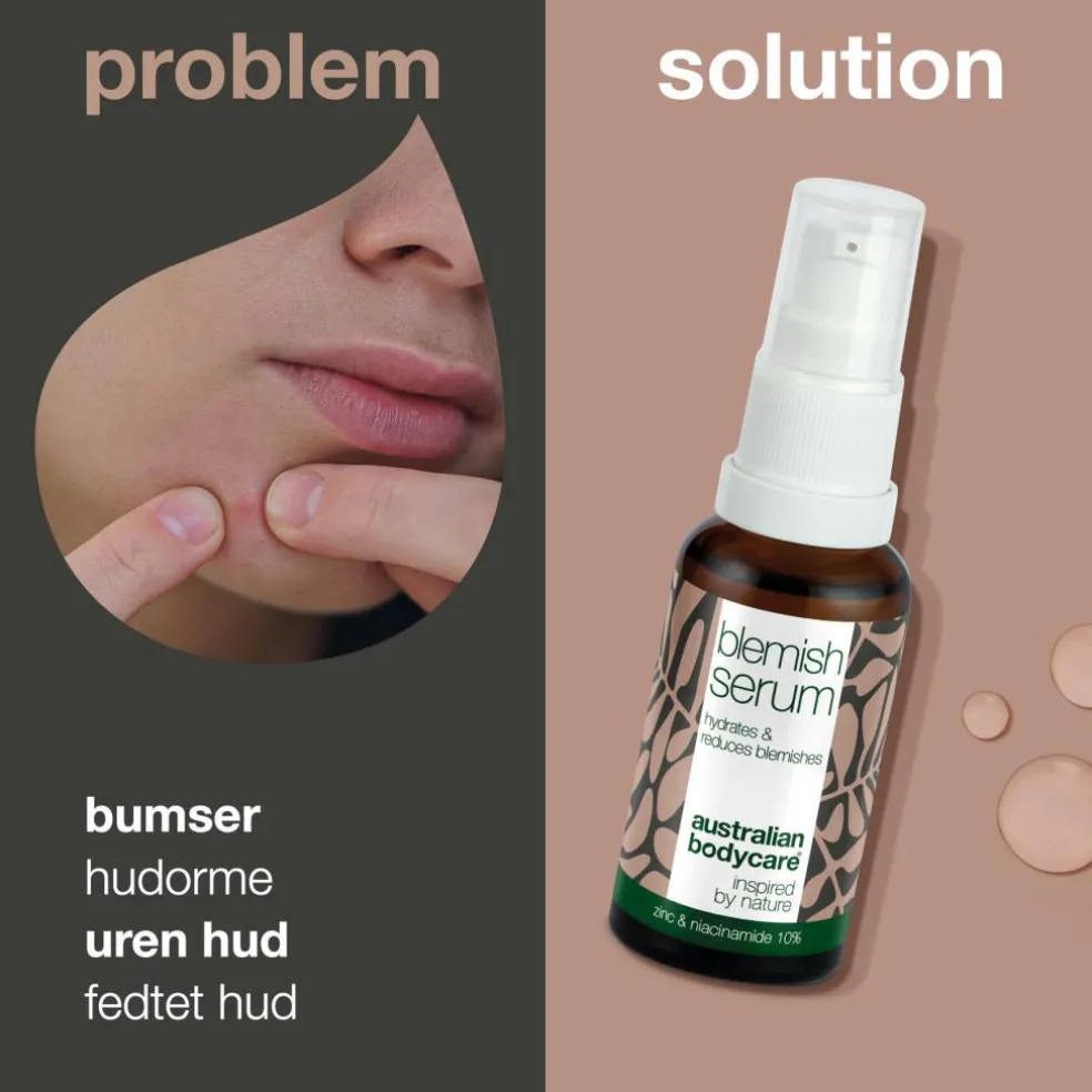 Niacinamide Blemish Serum