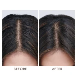 Oily Scalp Treatment