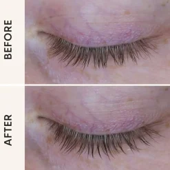 PRO Growth Serum