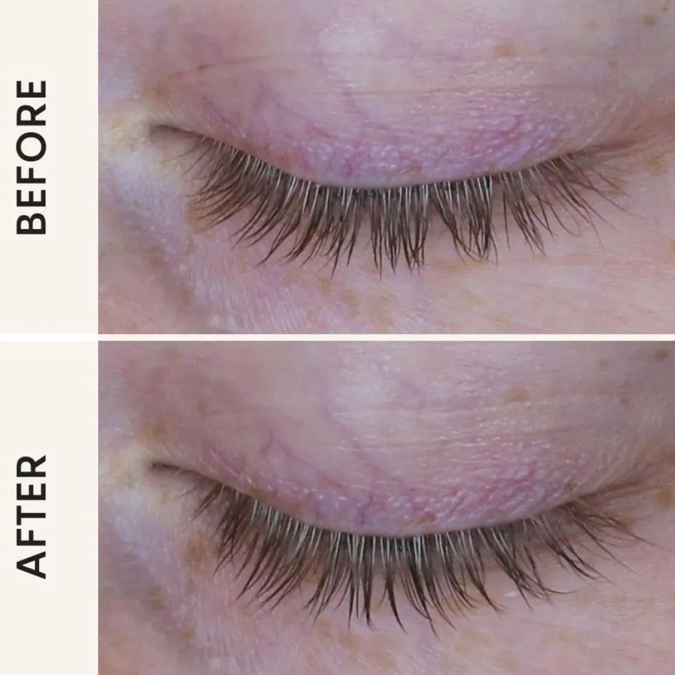 PRO Growth Serum