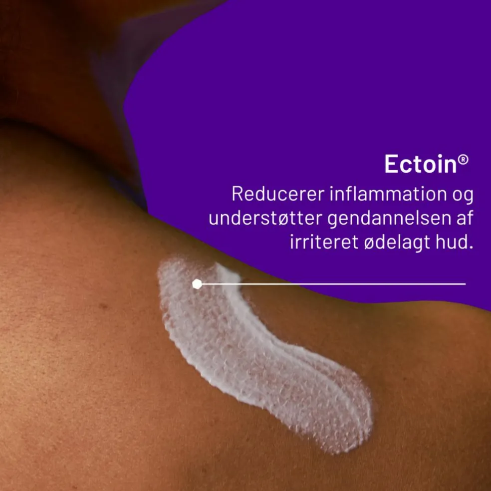 Psoriasis Cream
