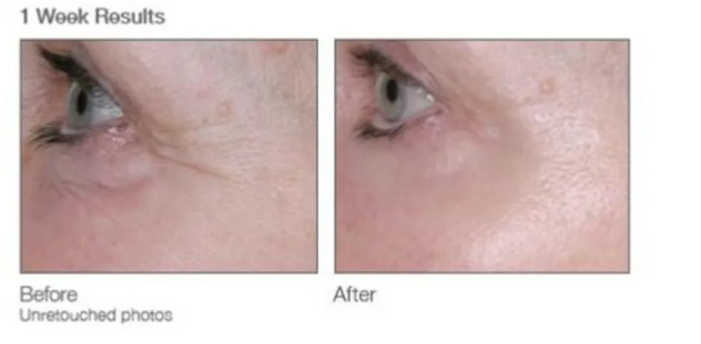 Renewing Eye Cream