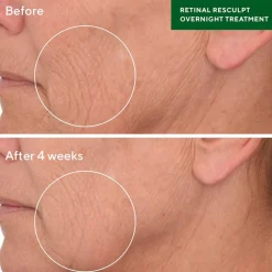 Retinal ReSculpt Overnight Treatment