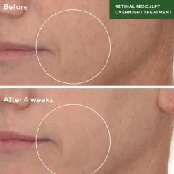 Retinal ReSculpt Overnight Treatment
