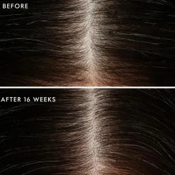 Revitalizing Scalp Tonic