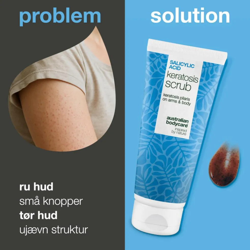 Salicylic Acid Keratosis Scrub