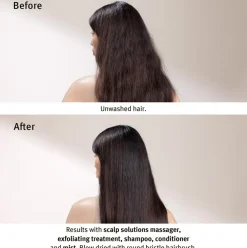 Scalp Solutions Balancing Shampoo