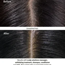 Scalp Solutions Stimulating Scalp Massager