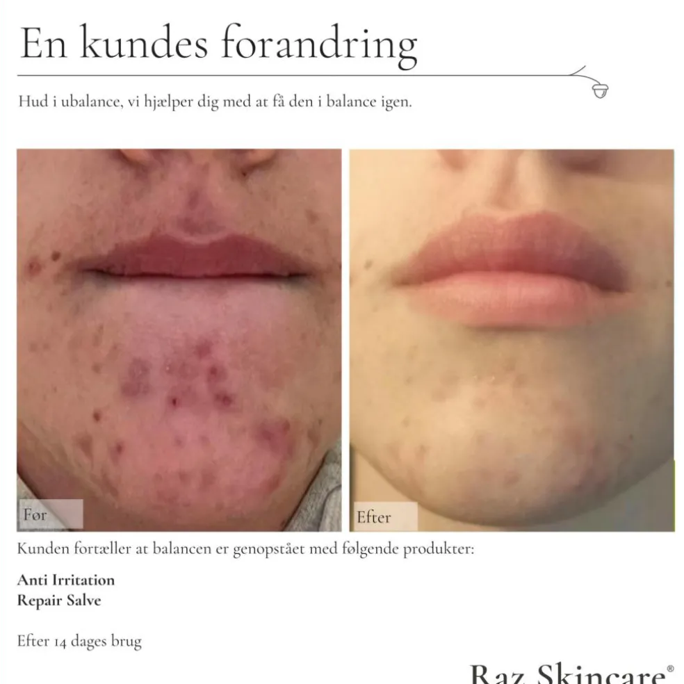 Skincare Repair Parfumefri