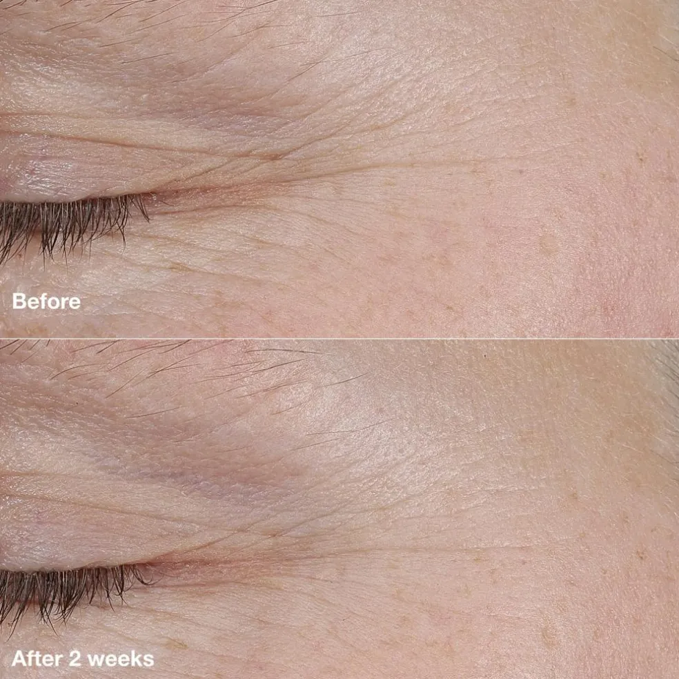Smart Clinical Repair AM/PM Retinoid Balm
