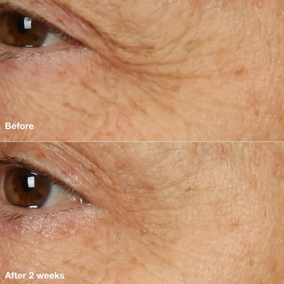 Smart Clinical Repair Overnight Recovery Cream and Mask