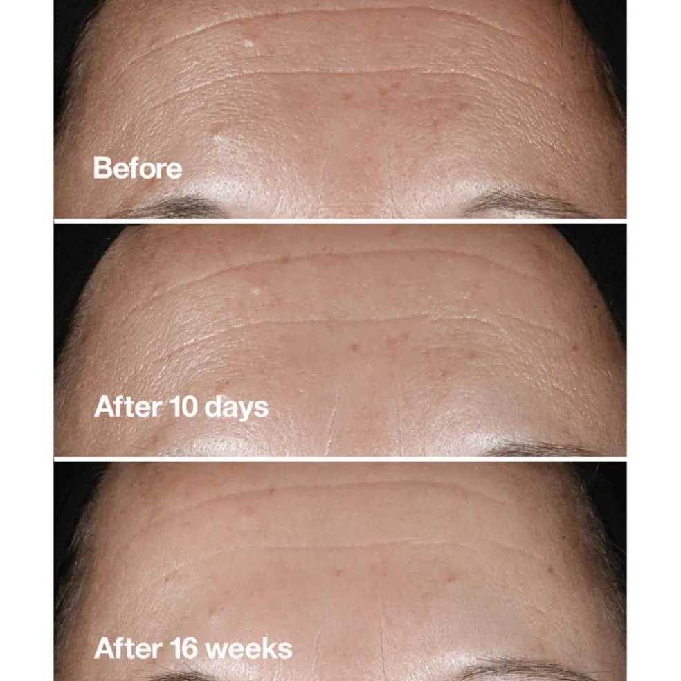 Smart Clinical Repair Wrinkle Correcting Serum