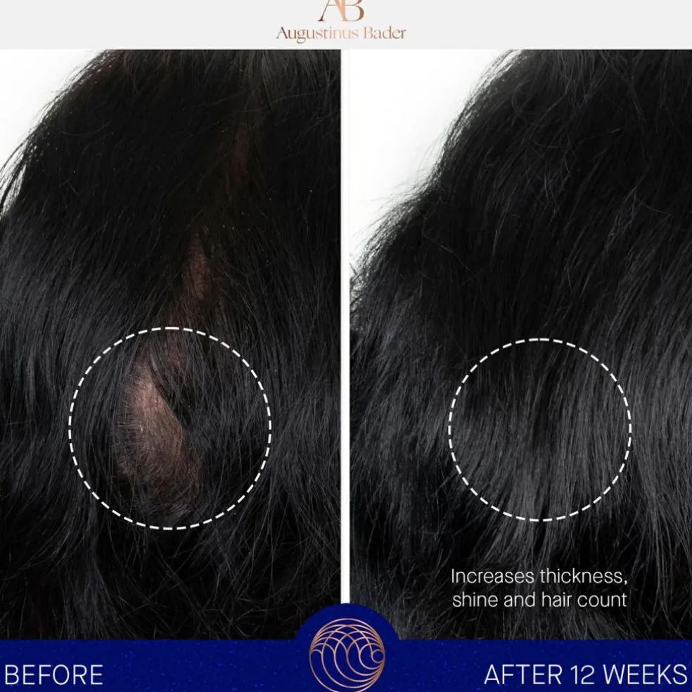 The Scalp Treatment