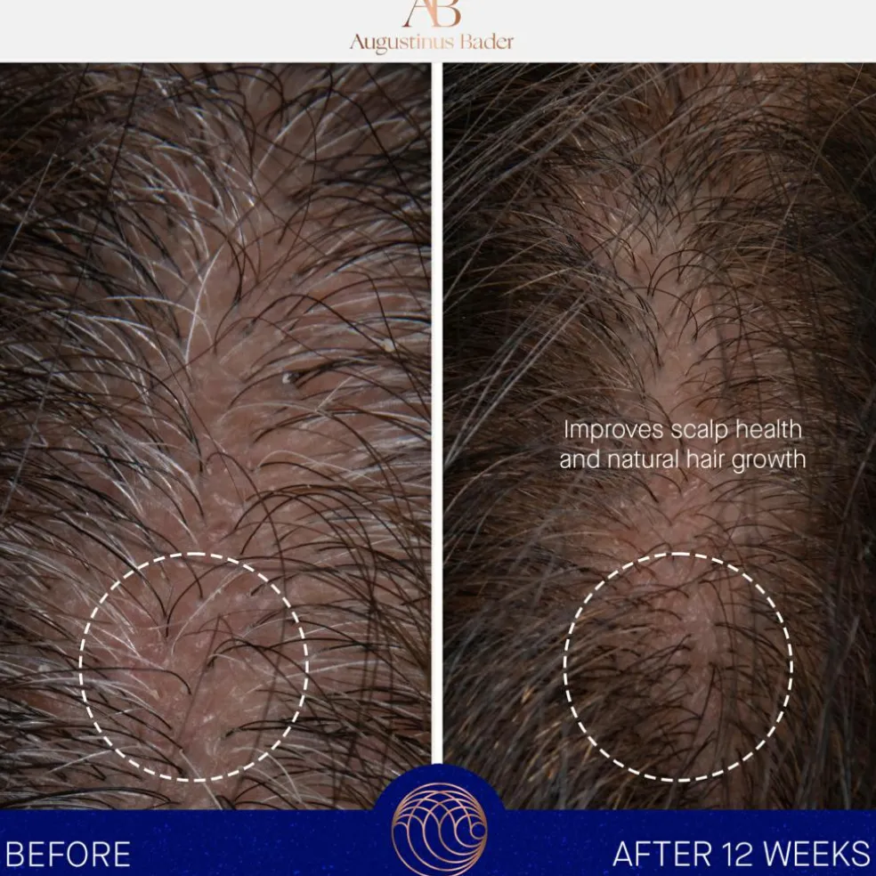 The Scalp Treatment