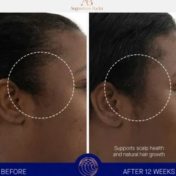 The Scalp Treatment