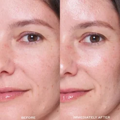 Transform Dewtopia 25% Acid Flash Facial